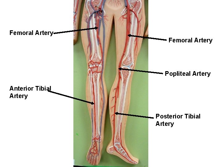 Femoral Artery Popliteal Artery Anterior Tibial Artery Posterior Tibial Artery 