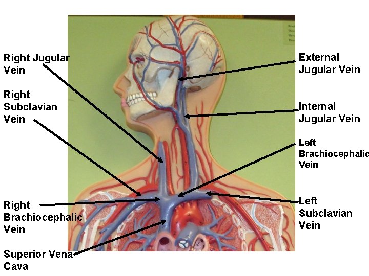 Right Jugular Vein External Jugular Vein Right Subclavian Vein Internal Jugular Vein Left Brachiocephalic