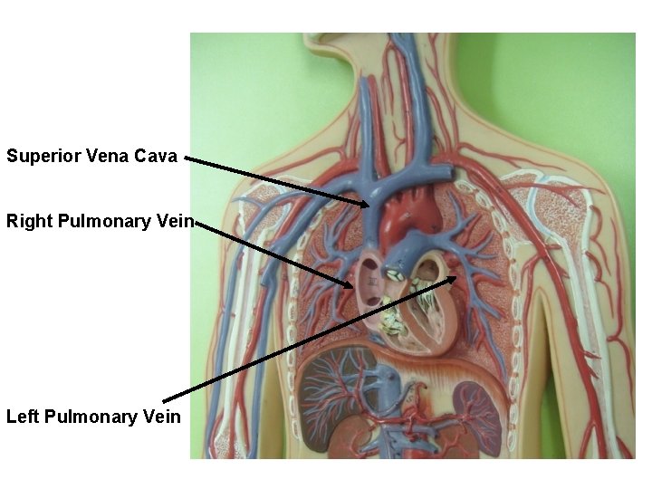 Superior Vena Cava Right Pulmonary Vein Left Pulmonary Vein 