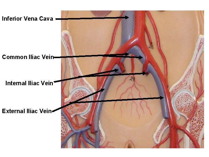 Inferior Vena Cava Common Iliac Vein Internal Iliac Vein External Iliac Vein 