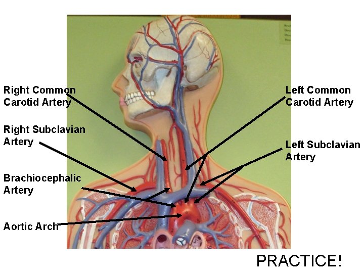 Right Common Carotid Artery Right Subclavian Artery Left Common Carotid Artery Left Subclavian Artery