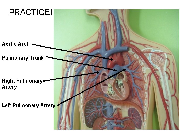 PRACTICE! Aortic Arch Pulmonary Trunk Right Pulmonary Artery Left Pulmonary Artery 