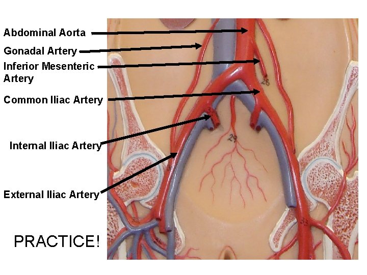 Abdominal Aorta Gonadal Artery Inferior Mesenteric Artery Common Iliac Artery Internal Iliac Artery External