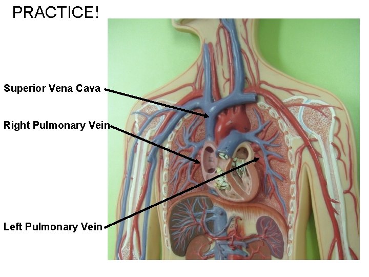 PRACTICE! Superior Vena Cava Right Pulmonary Vein Left Pulmonary Vein 