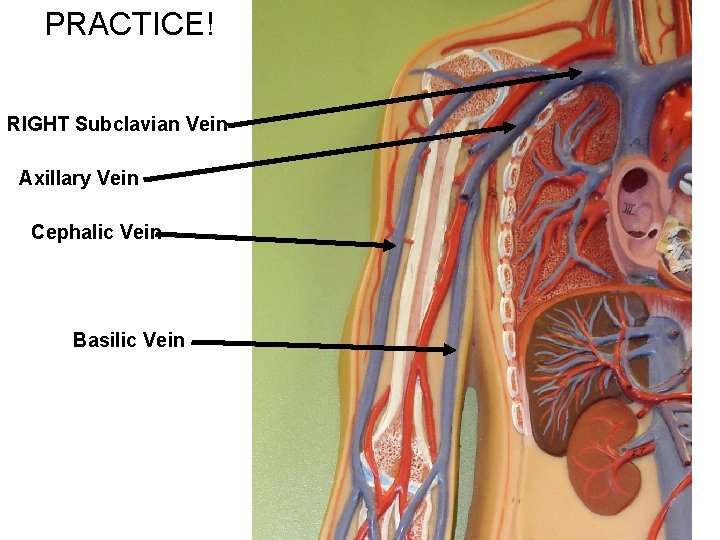 PRACTICE! RIGHT Subclavian Vein Axillary Vein Cephalic Vein Basilic Vein 