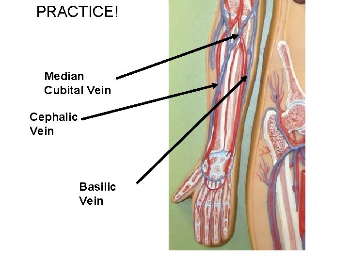 PRACTICE! Median Cubital Vein Cephalic Vein Basilic Vein 