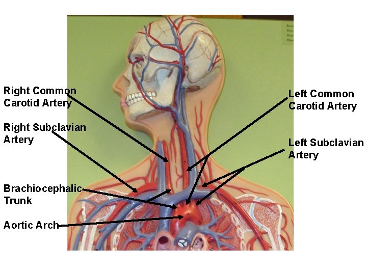 Right Common Carotid Artery Right Subclavian Artery Brachiocephalic Trunk Aortic Arch Left Common Carotid