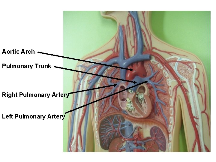 Aortic Arch Pulmonary Trunk Right Pulmonary Artery Left Pulmonary Artery 