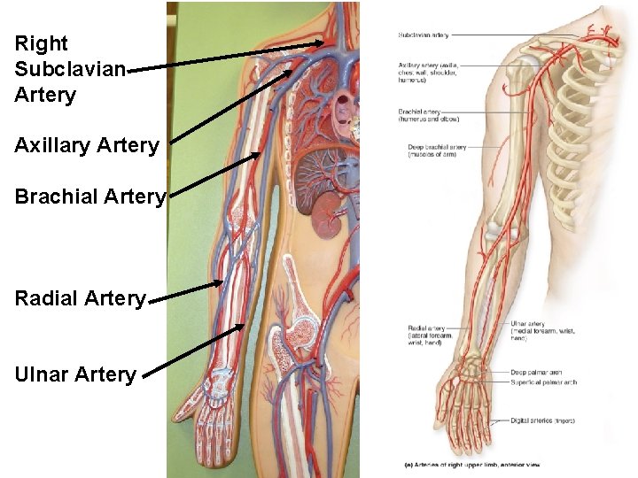 Right Subclavian Artery Axillary Artery Brachial Artery Radial Artery Ulnar Artery 