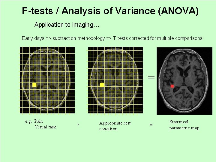 F-tests / Analysis of Variance (ANOVA) Application to imaging… Early days => subtraction methodology