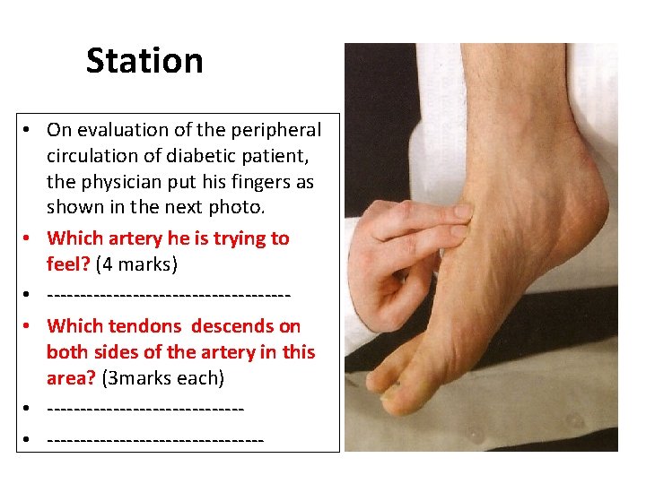 Station • On evaluation of the peripheral circulation of diabetic patient, the physician put