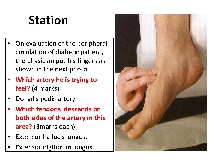 Station • On evaluation of the peripheral circulation of diabetic patient, the physician put