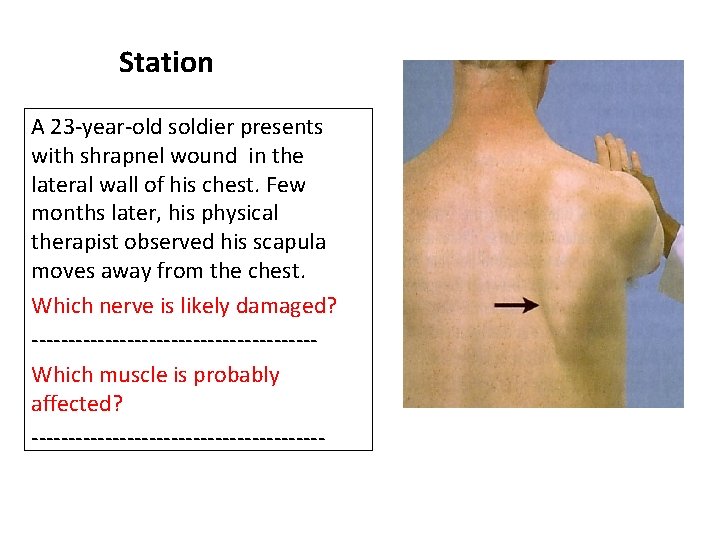 Station A 23 -year-old soldier presents with shrapnel wound in the lateral wall of