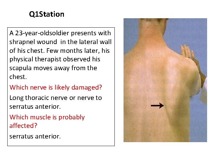 Q 1 Station A 23 -year-oldsoldier presents with shrapnel wound in the lateral wall