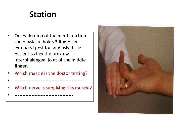 Station • On evaluation of the hand function the physician holds 3 fingers in