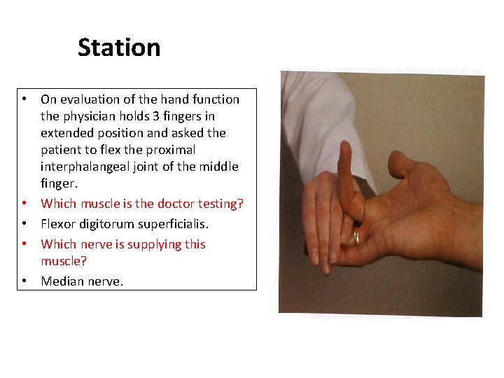 Station • On evaluation of the hand function the physician holds 3 fingers in