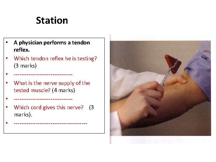 Station • A physician performs a tendon reflex. • Which tendon reflex he is