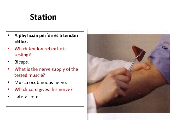 Station • A physician performs a tendon reflex. • Which tendon reflex he is