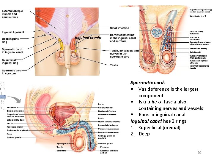 Inguinal hernia Spermatic cord: • Vas deference is the largest component • Is a