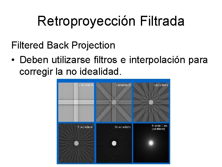 Retroproyección Filtrada Filtered Back Projection • Deben utilizarse filtros e interpolación para corregir la
