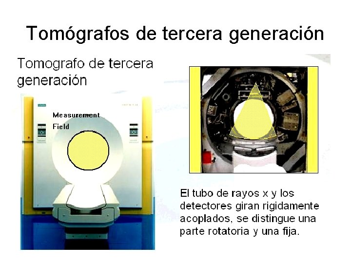 Tomógrafos de tercera generación 