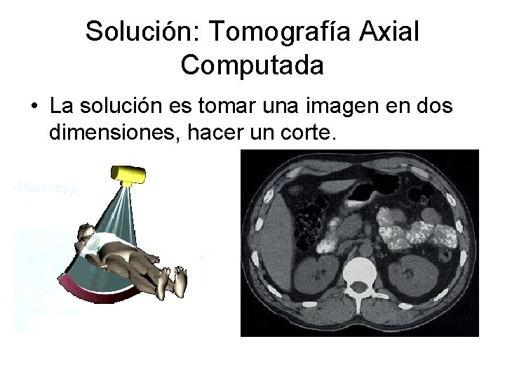 Solución: Tomografía Axial Computada • La solución es tomar una imagen en dos dimensiones,