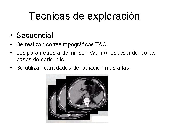 Técnicas de exploración • Secuencial • Se realizan cortes topográficos TAC. • Los parámetros