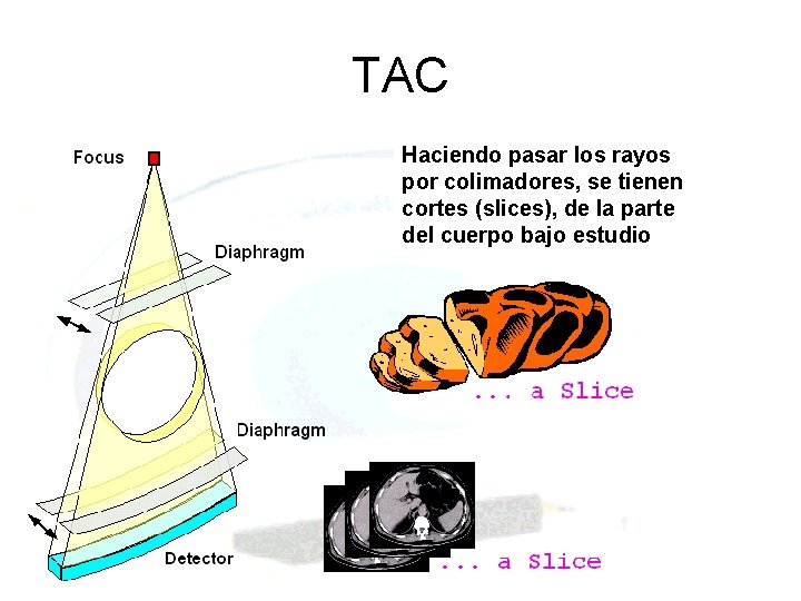 TAC Haciendo pasar los rayos por colimadores, se tienen cortes (slices), de la parte