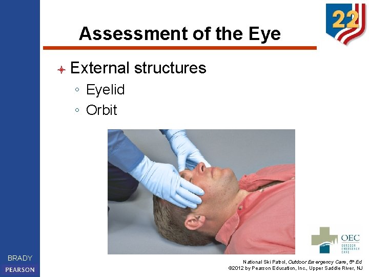 Assessment of the Eye l External structures ◦ Eyelid ◦ Orbit BRADY National Ski