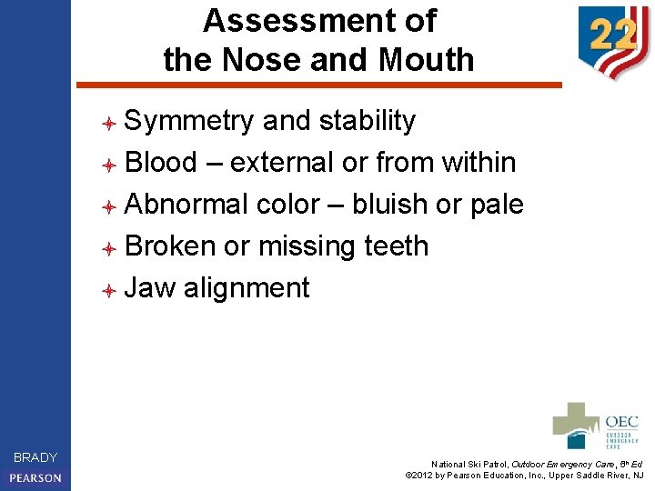 Assessment of the Nose and Mouth l Symmetry and stability l Blood – external