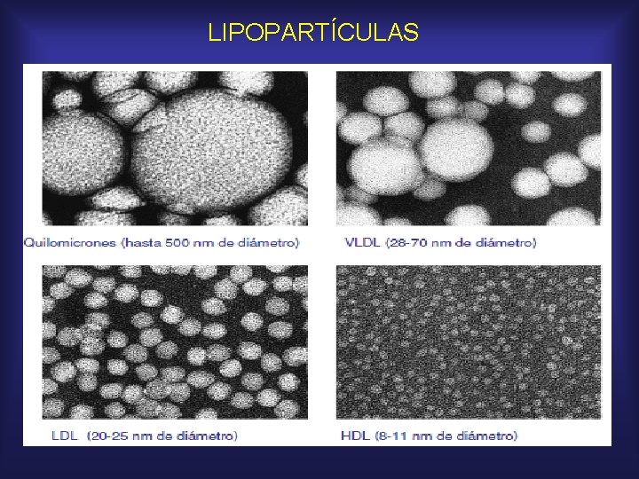 LIPOPARTÍCULAS 