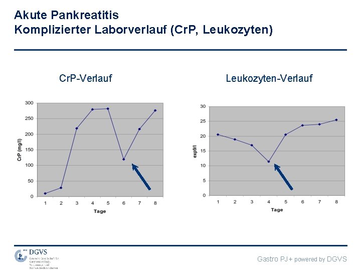 Akute Pankreatitis Komplizierter Laborverlauf (Cr. P, Leukozyten) Cr. P-Verlauf Leukozyten-Verlauf Gastro PJ+ powered by