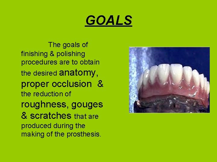 GOALS The goals of finishing & polishing procedures are to obtain the desired anatomy,