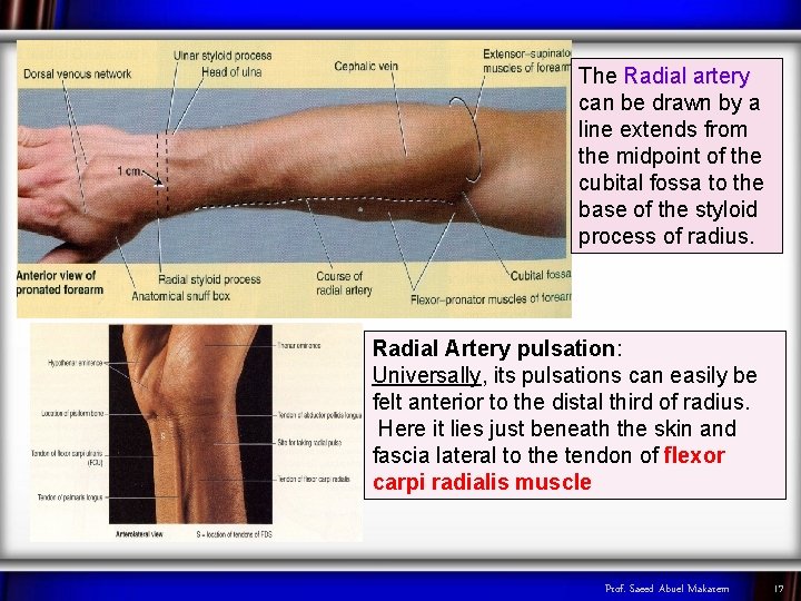 The Radial artery can be drawn by a line extends from the midpoint of