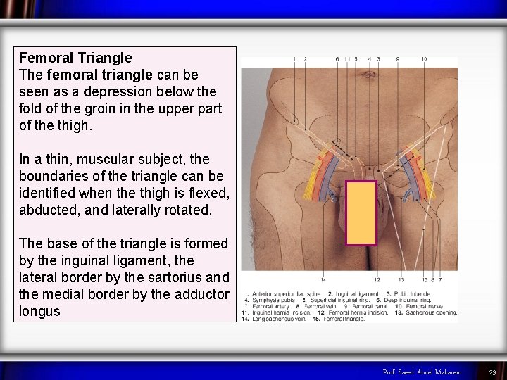 Femoral Triangle The femoral triangle can be seen as a depression below the fold