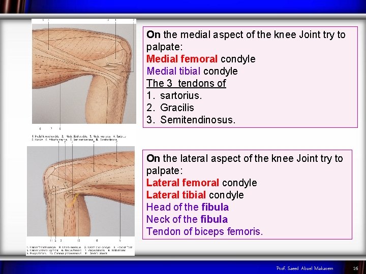 On the medial aspect of the knee Joint try to palpate: Medial femoral condyle