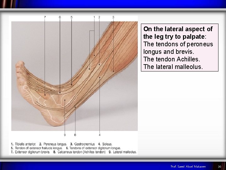 On the lateral aspect of the leg try to palpate: The tendons of peroneus