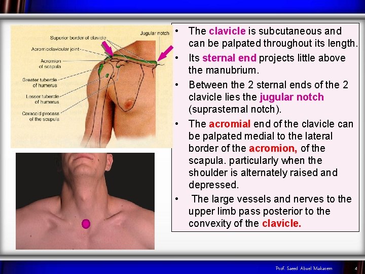  • The clavicle is subcutaneous and can be palpated throughout its length. •