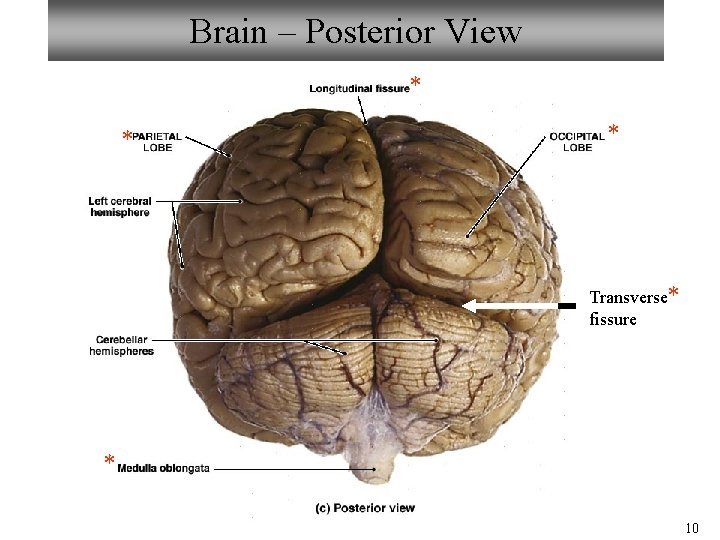Brain – Posterior View * * * Transverse* fissure * 10 Brain – Posterior View * * * Transverse* fissure * 10