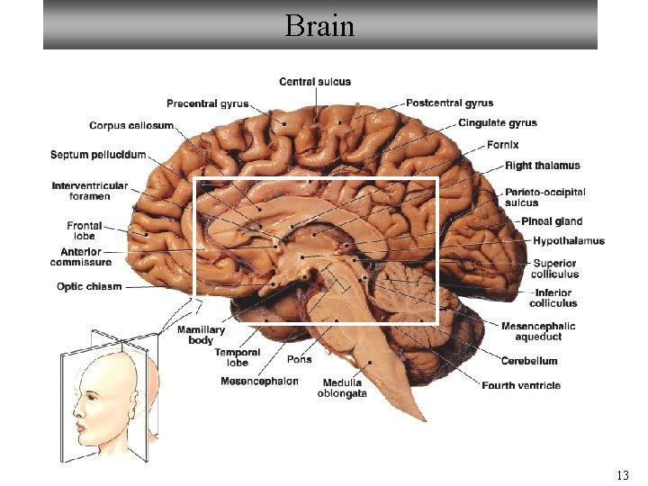 Brain 13 