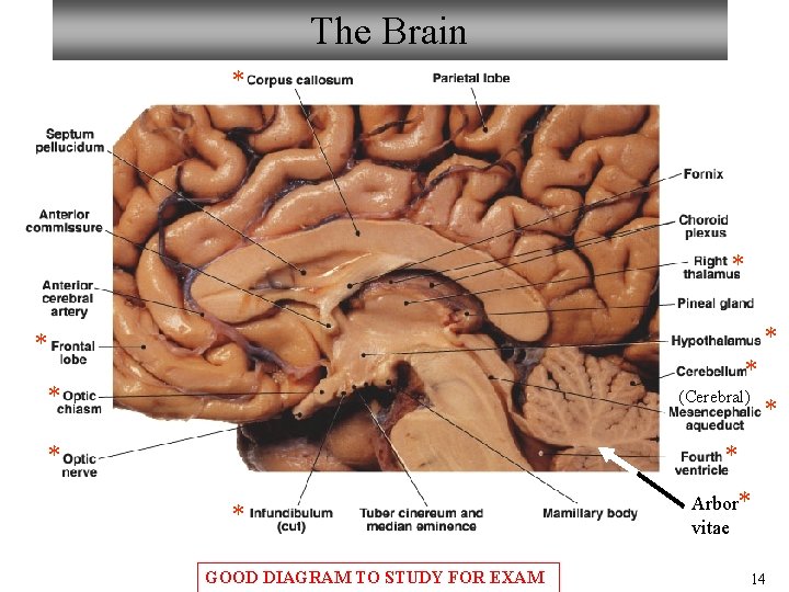 The Brain * * * (Cerebral) * * GOOD DIAGRAM TO STUDY FOR EXAM The Brain * * * (Cerebral) * * GOOD DIAGRAM TO STUDY FOR EXAM