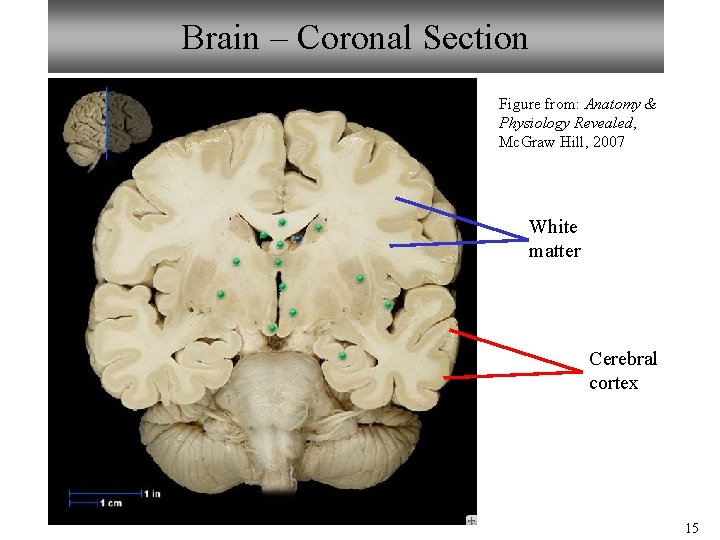 Brain – Coronal Section Figure from: Anatomy & Physiology Revealed, Mc. Graw Hill, 2007