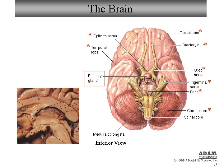 The Brain * * * * Inferior View 17 The Brain * * * * Inferior View 17