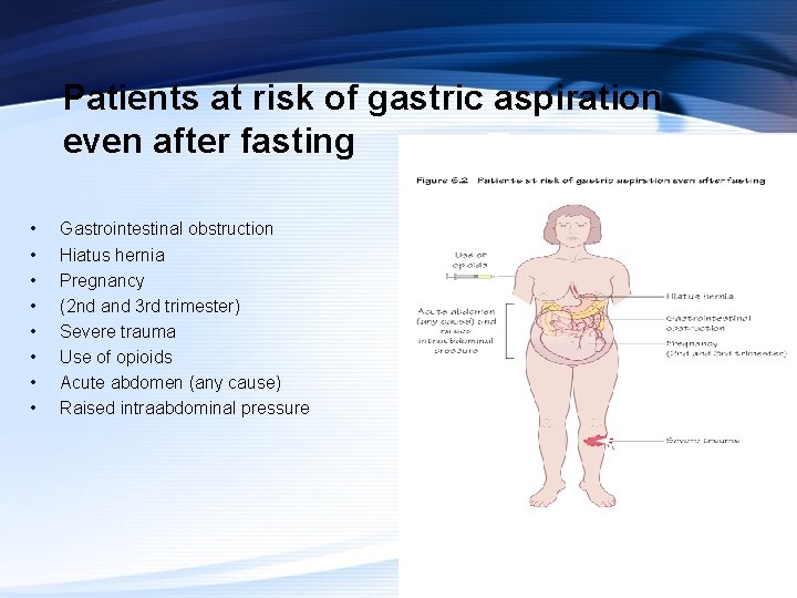Patients at risk of gastric aspiration even after fasting • • Gastrointestinal obstruction Hiatus