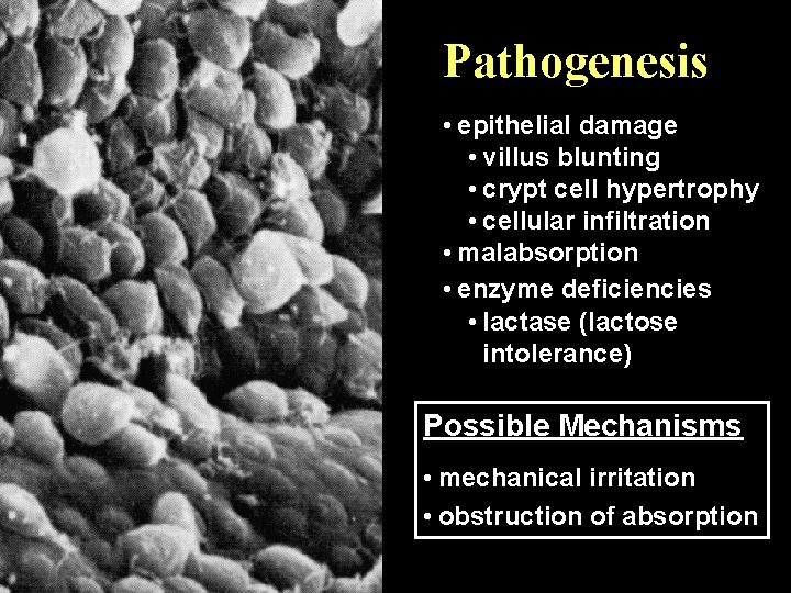 Pathogenesis • epithelial damage • villus blunting • crypt cell hypertrophy • cellular infiltration