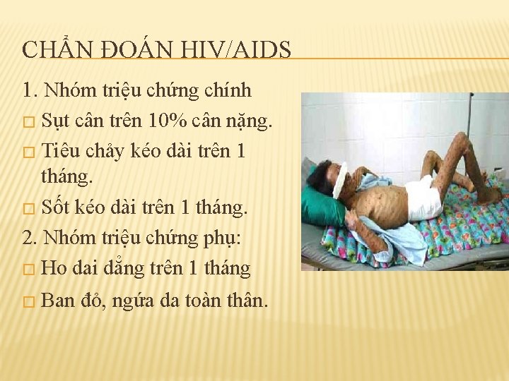 CHẨN ĐOÁN HIV/AIDS 1. Nhóm triệu chứng chính � Sụt cân trên 10% cân