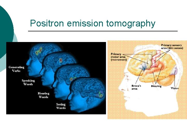 Positron emission tomography 