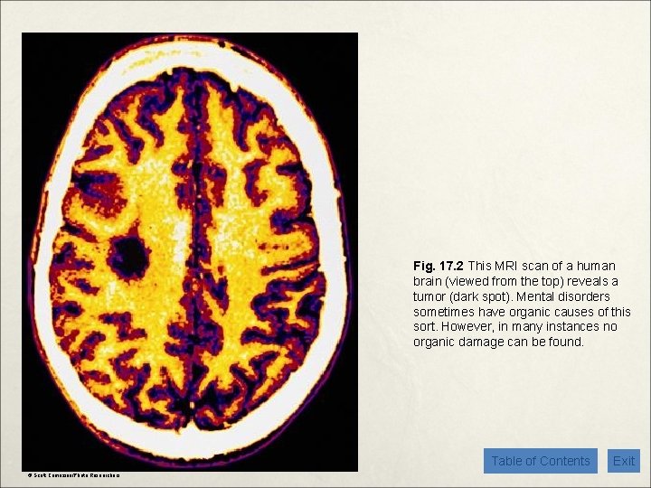 Fig. 17. 2 This MRI scan of a human brain (viewed from the top)