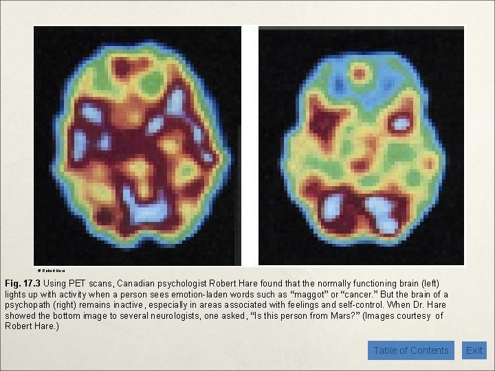 © Robert Hare Fig. 17. 3 Using PET scans, Canadian psychologist Robert Hare found