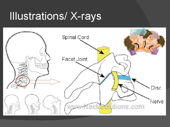 Illustrations/ X-rays 